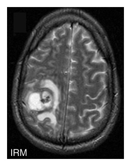 En savoir plus - Imagerie médicale