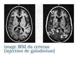 En savoir plus - Imagerie médicale