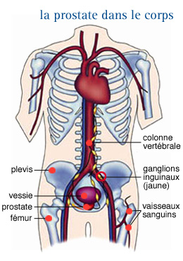 ganglion lymphatique prostate exacerbarea prostatitei în timpul efortului fizic