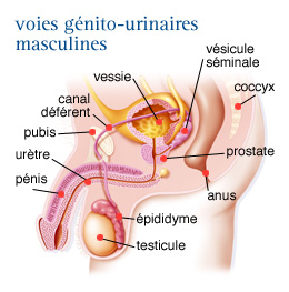 ganglion iliaque cancer prostate