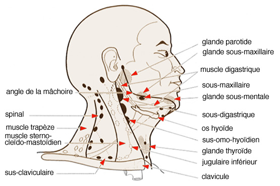 Cancers du larynx (cancers de la gorge)