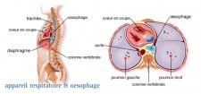 Cancer de l'œsophage