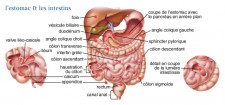 Cancer de l'estomac (gastrique)