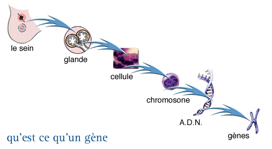 Cancer du sein