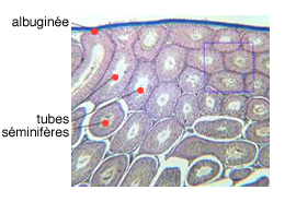 Cancer du testicule