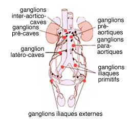 Cancer du testicule