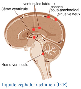 Tumeurs cérébrales