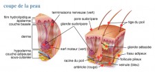 Mélanomes