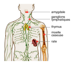 Myélome Multiple