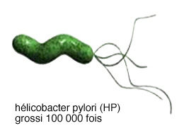 Lyphome non hodgkiniens