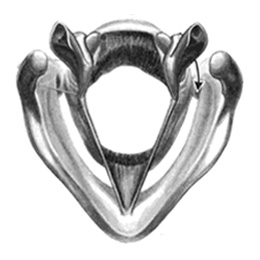 Cancers de la gorge (larynx)