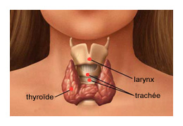 Cancer de la thyroïde