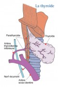 Cancer de la thyroïde