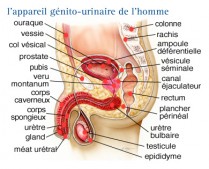 Cancers de la vessie