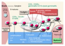 Le lymphome