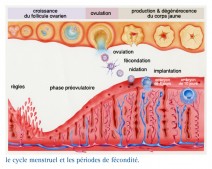 Cancer de l'ovaire