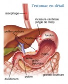 Cancer de l'estomac (gastrique)