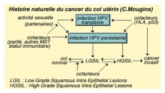 Cancer du col de l'utérus